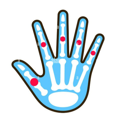 Treatment for Arthritis 